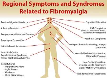 Fibromyalgia Symptoms