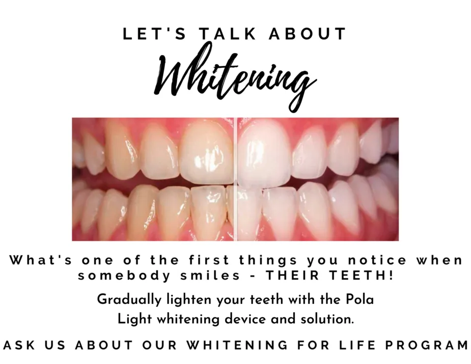 Teeth Whitening- Whitening for Life