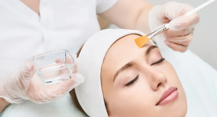 Chemical Peel in Douglasville GA