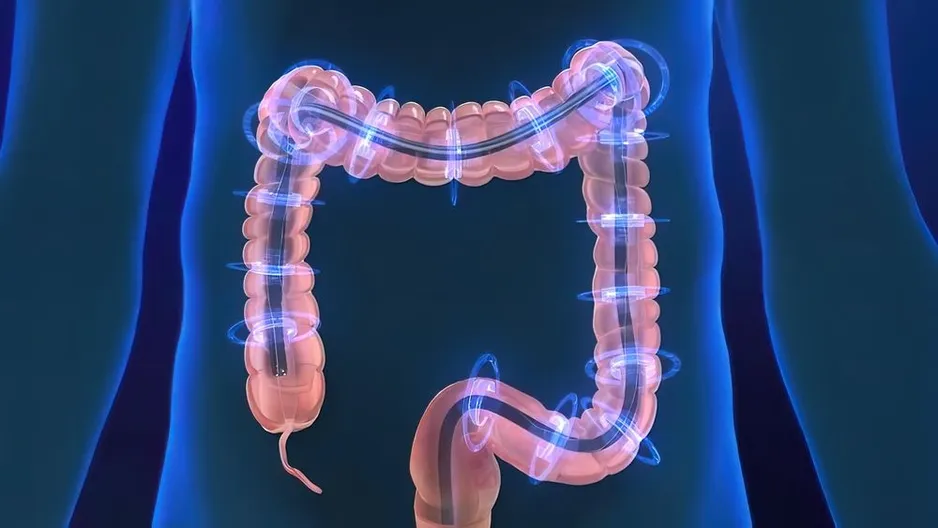 Colonoscopy in Murray Hill and Serving New York, NY