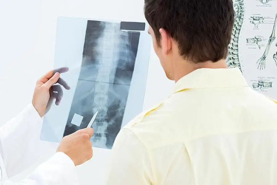 X-ray in Chiropractic Care