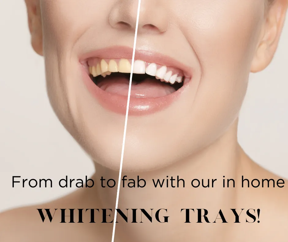 Burlington, NC dentist, free whitening