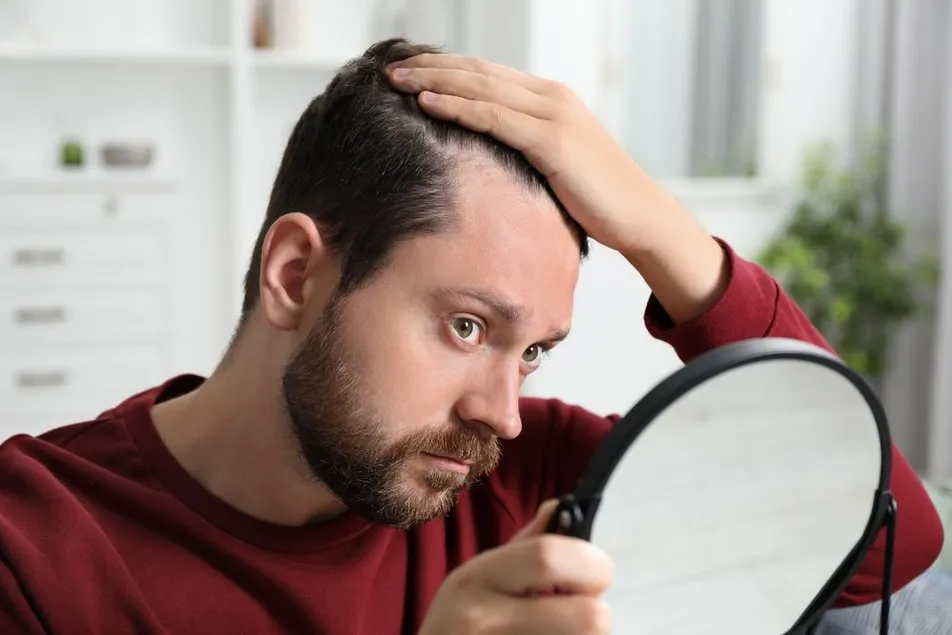 hair loss in Boise, ID