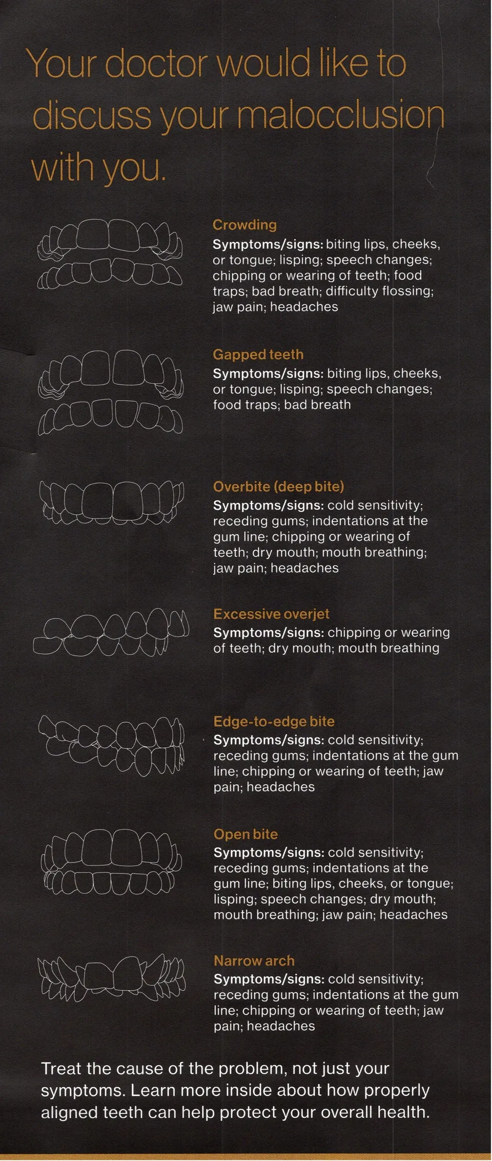 misaligned_teeth