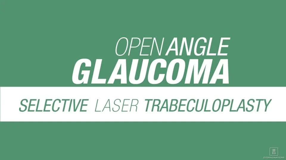 open angle glaucoma