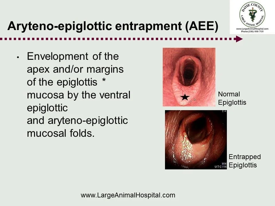 Envelopment of the apex and/or margins of the epiglottis * mucosa by the ventral epiglottic andaryteno-epiglottic mucosal folds.