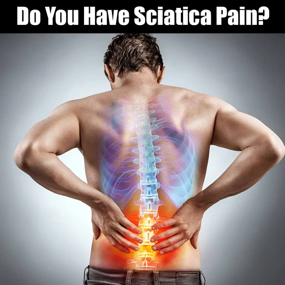 sciatica