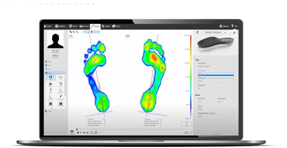 superfeet custom orthotics