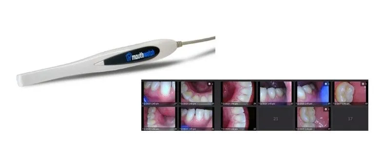 intraoral