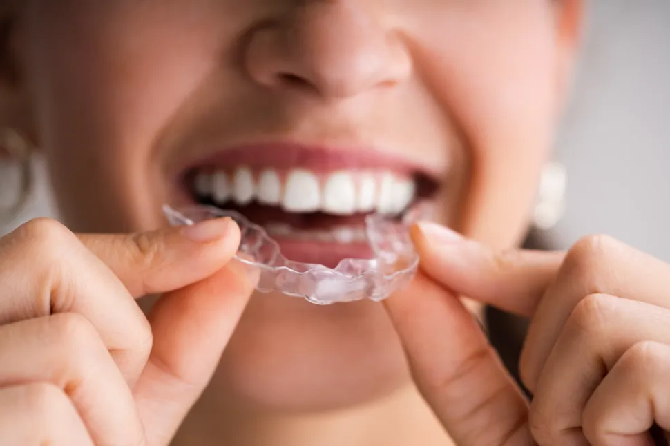 Invisalign Bellevue, Orthodontics