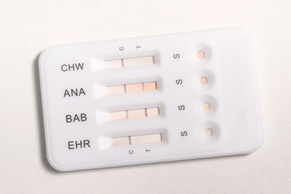 The Top Benefits of Regular Heartworm Testing for Your Pet