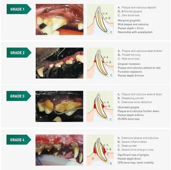 Dental Grading System