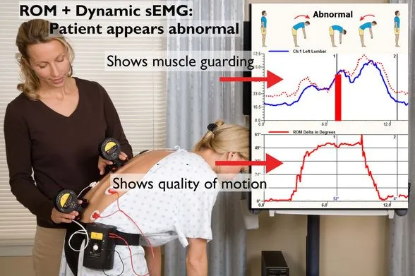 Static Semg Dynarom Semg