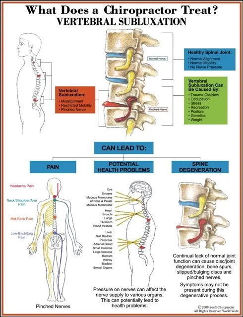 subluxationfinal11.7.08.jpg