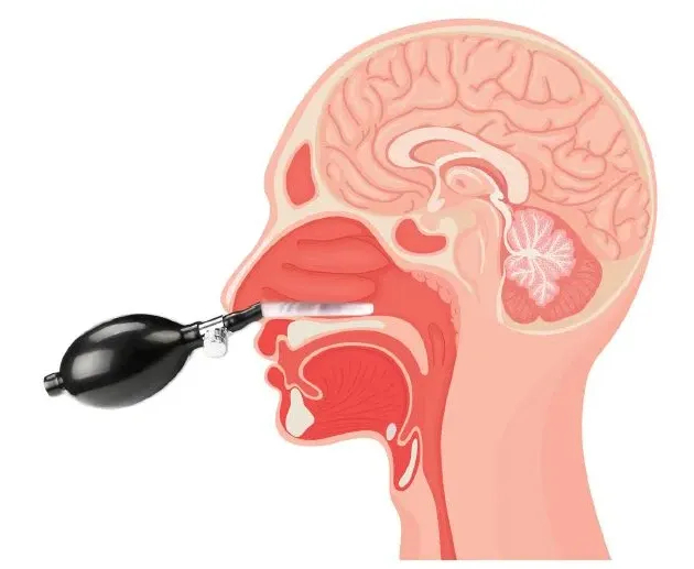 Cranial facial release 1