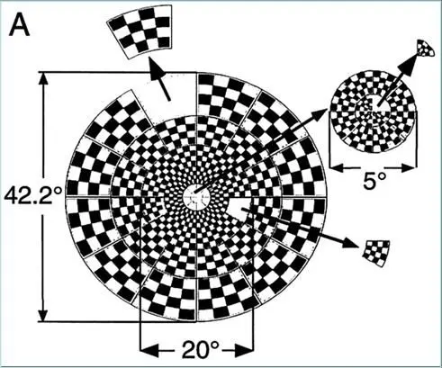 Pattern Visual Evoked Response Test Image