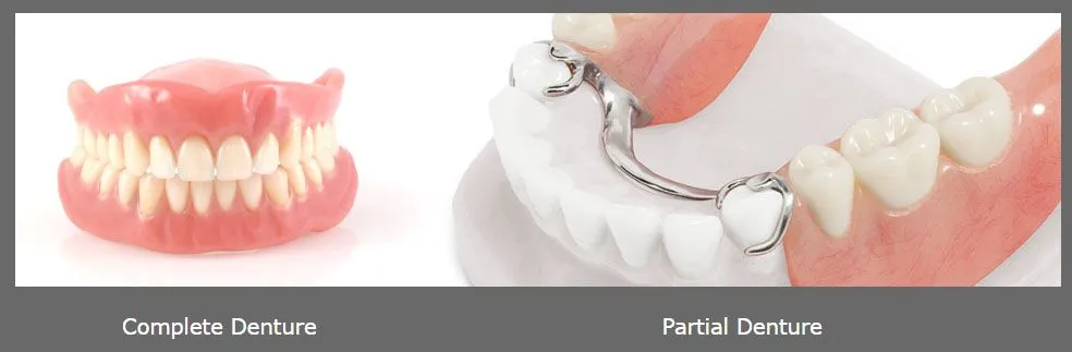 denturess.jpg