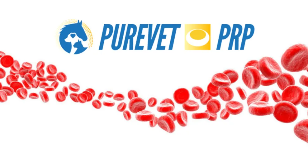 Platelet Rich Plasma (PRP)