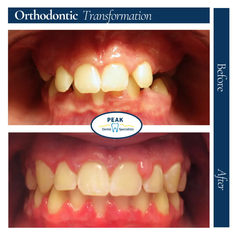 liam's tranformation