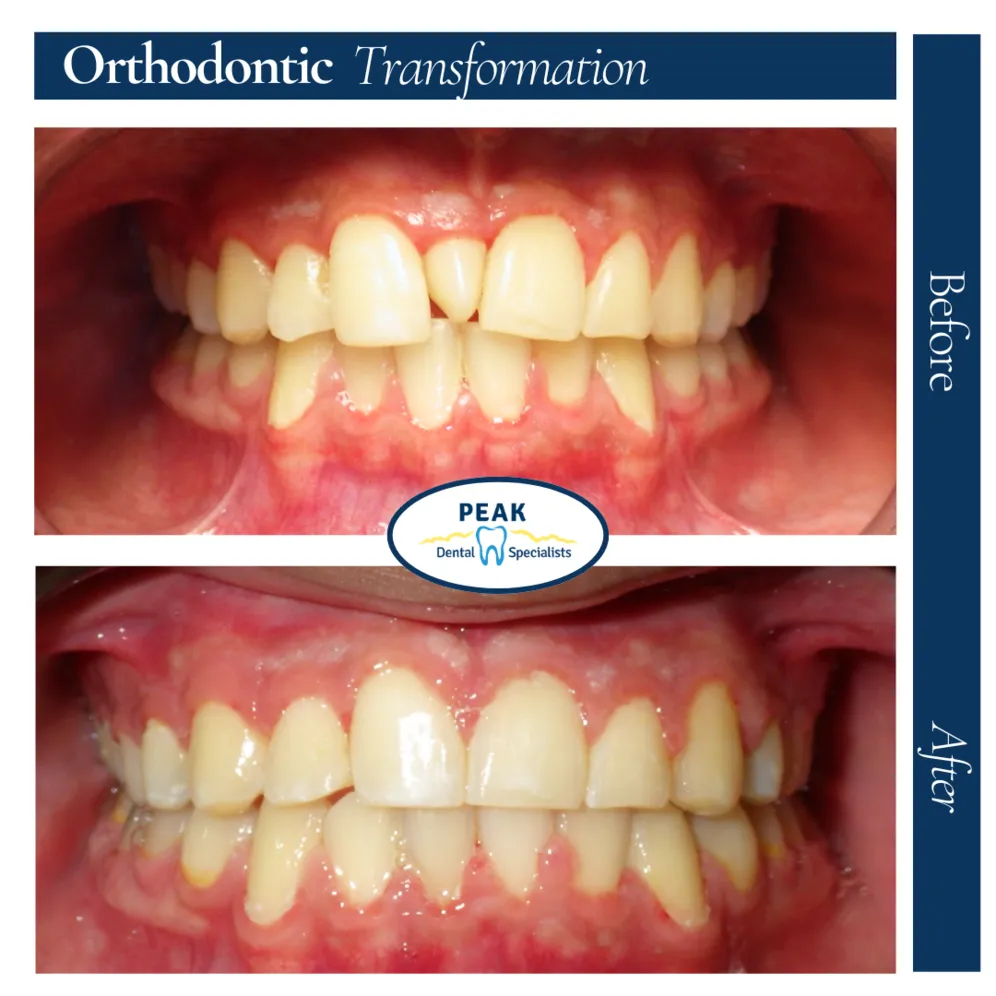 javier's transformation
