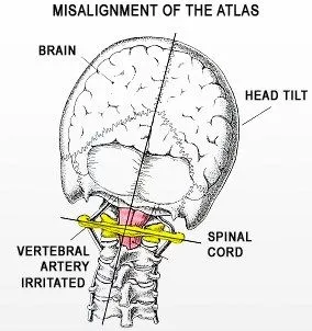 atlas